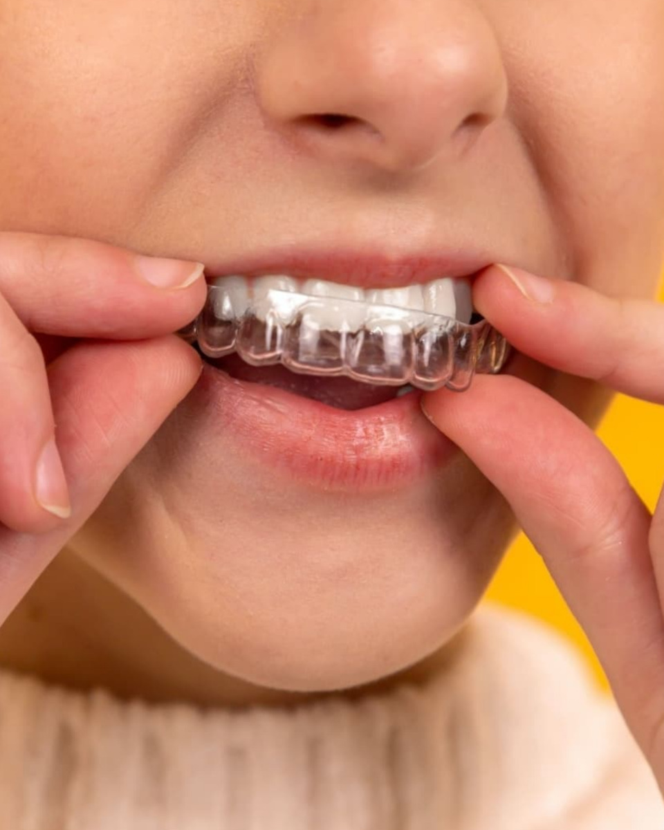 Aligner in Schwerte